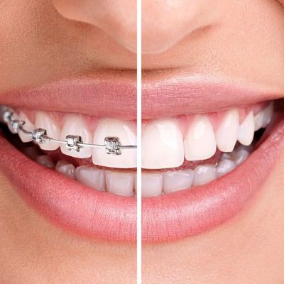 Dentist in west Bloomfield