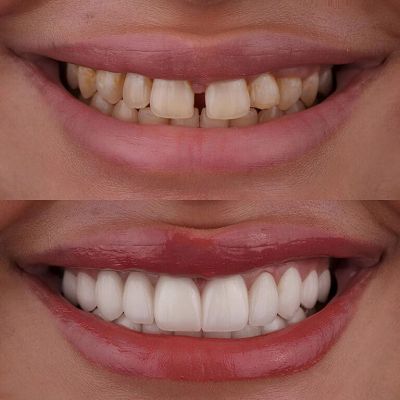 Dentist in west Bloomfield