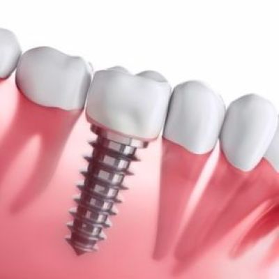 Dentist in west Bloomfield
