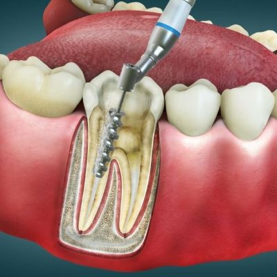 Dentist in west Bloomfield